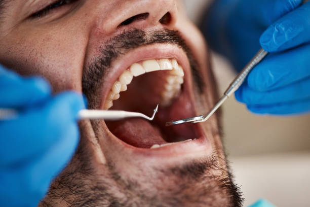Best Emergency Dentist Near Me  in Rayre, MO